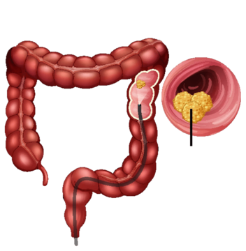 Colorectal Surgeon